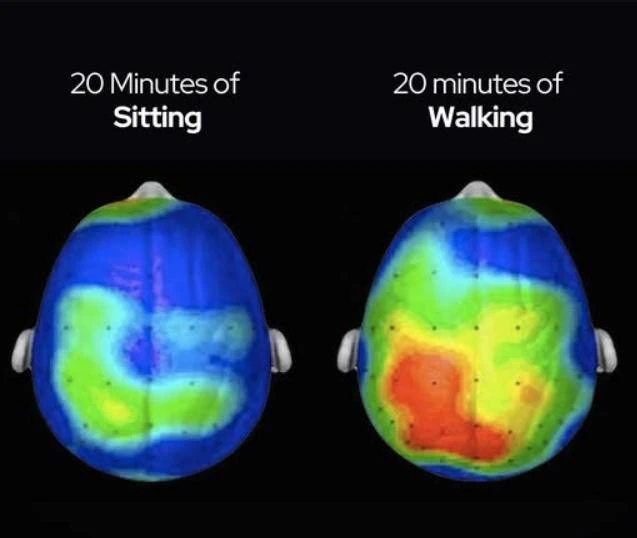 اسکن مغز پس از ۲۰ دقیقه نشستن و راه رفتن